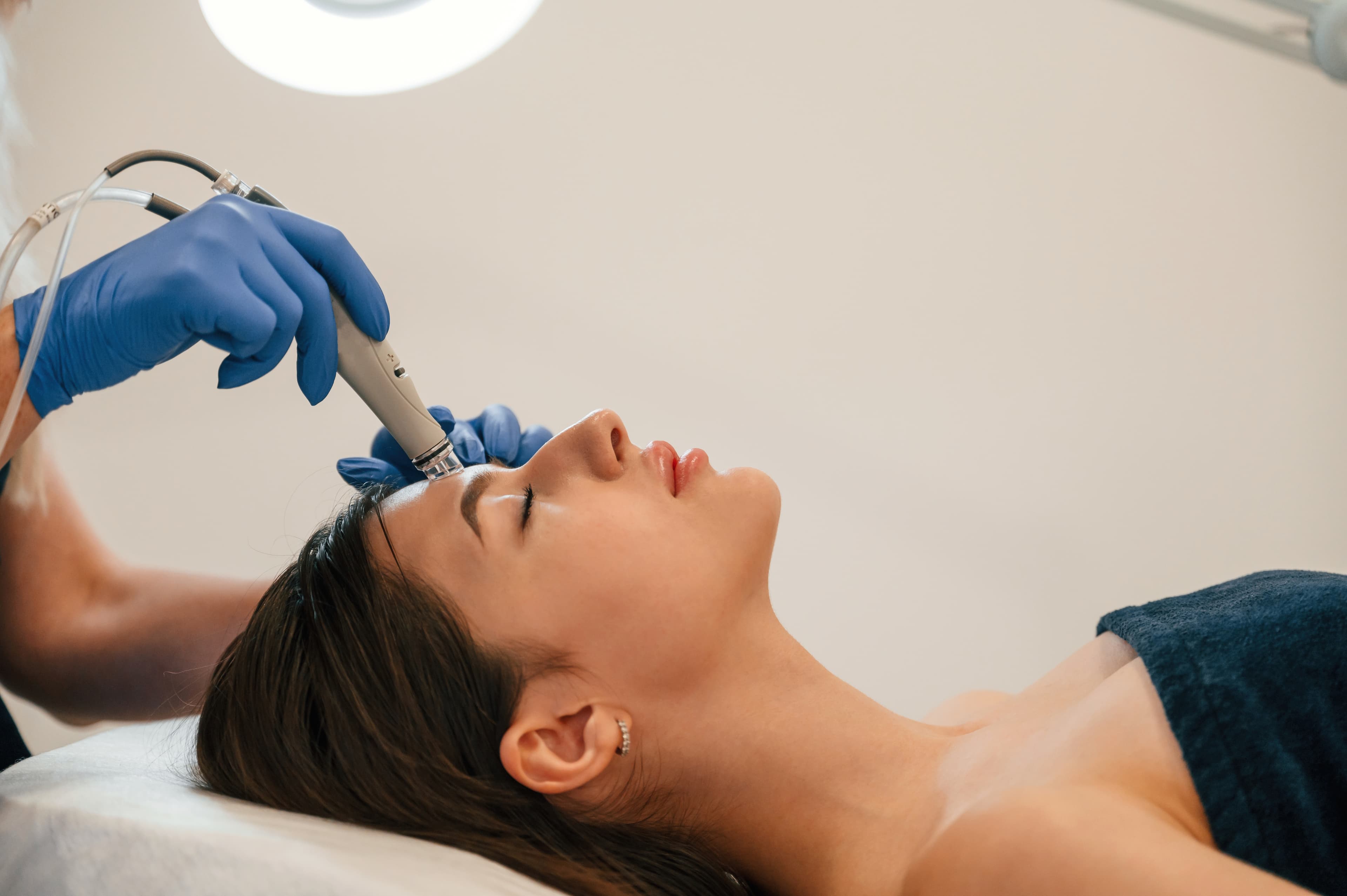 Microneedling